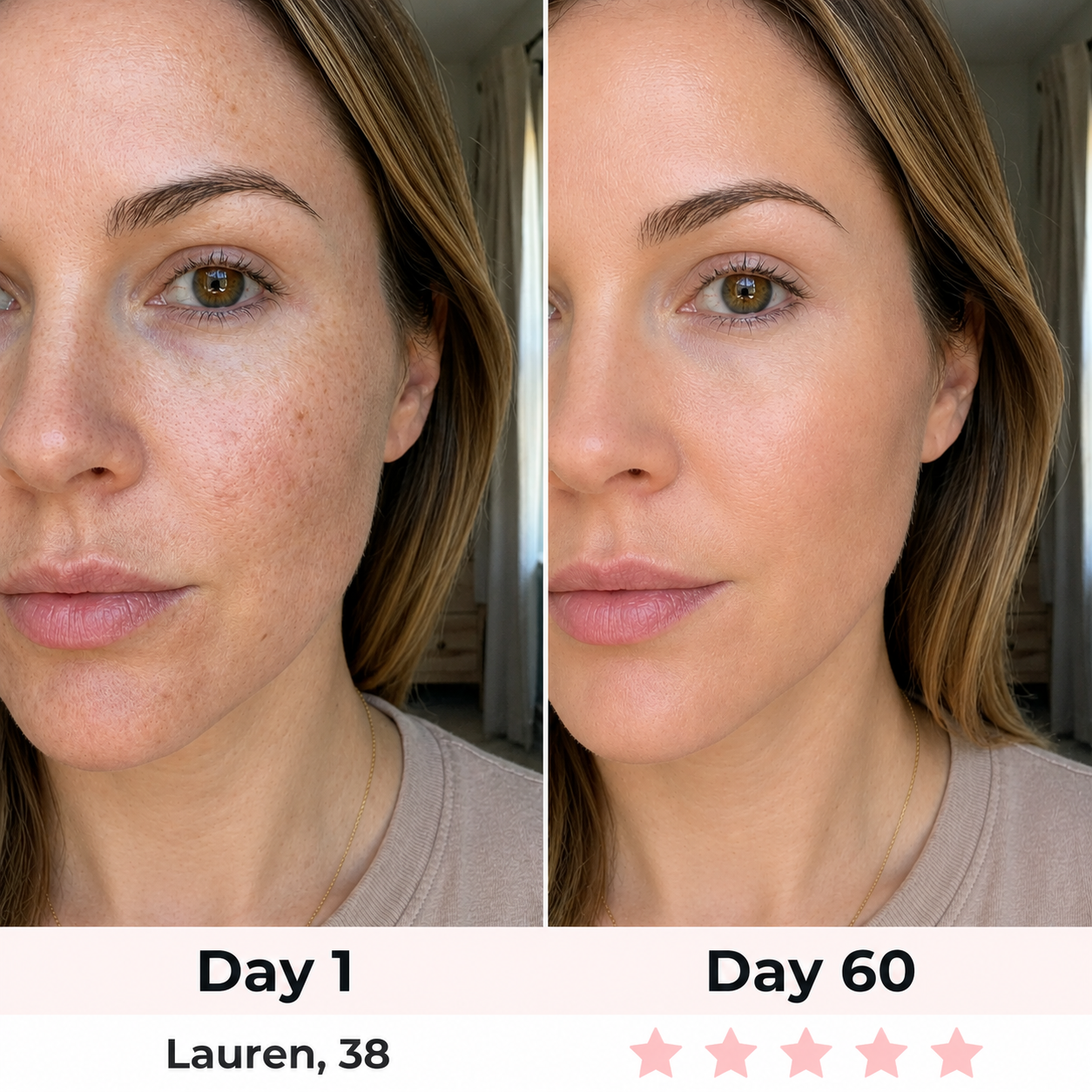 LyraGlow™ Red Light Therapy Face Mask
