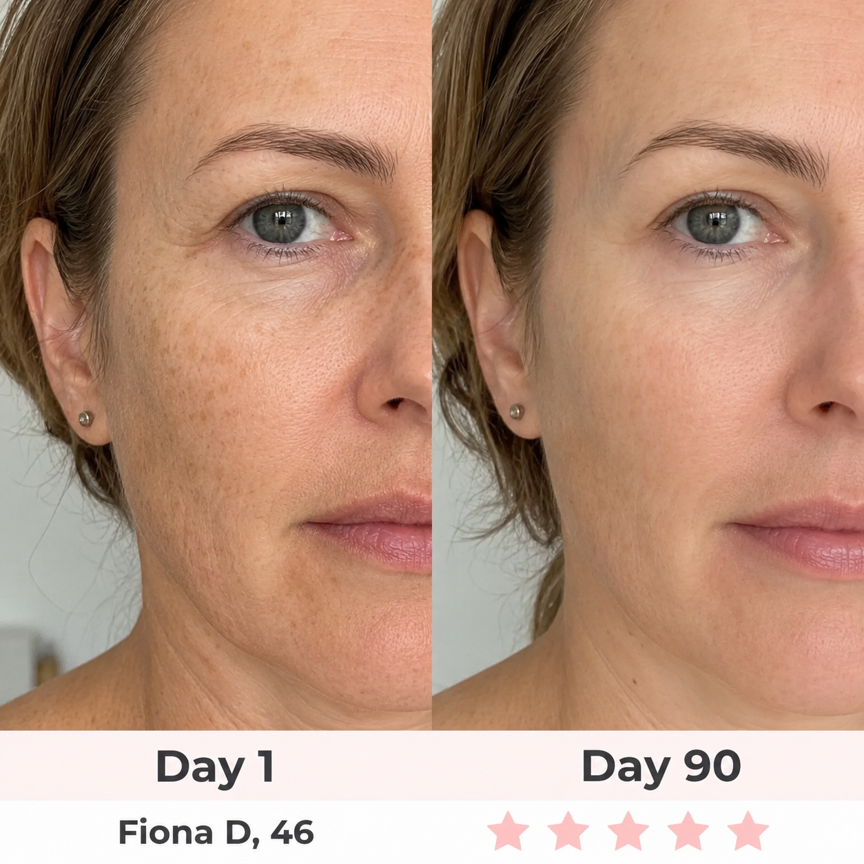 LyraGlow™ 2-in-1 Red Light Therapy + EMS To Erase Eye Bags