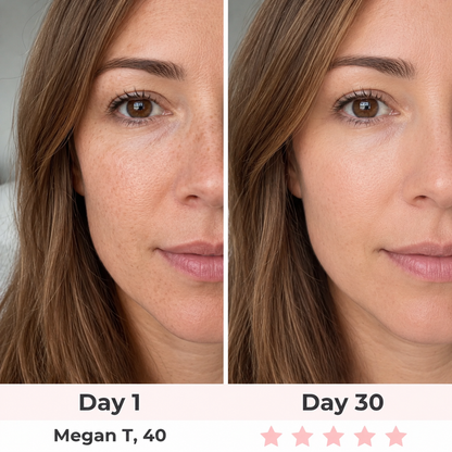 LyraGlow™ 2-in-1 Red Light Therapy + EMS To Erase Eye Bags