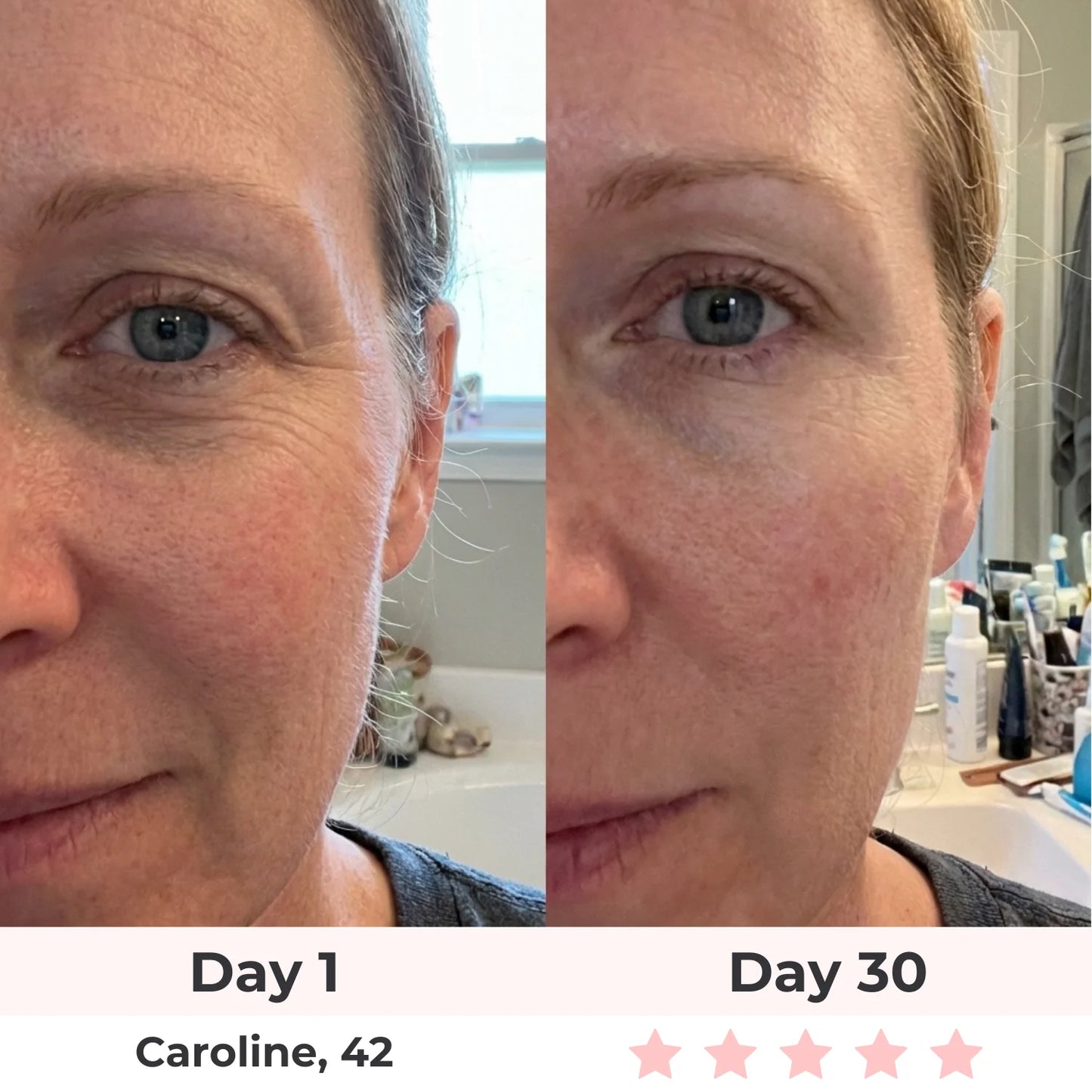 LyraGlow™ Red Light Therapy Face Mask