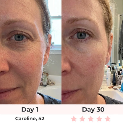 LyraGlow™ Red Light Therapy Face Mask