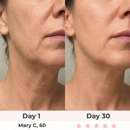 LyraGlow™ EMS Neck & Face Tightening Device