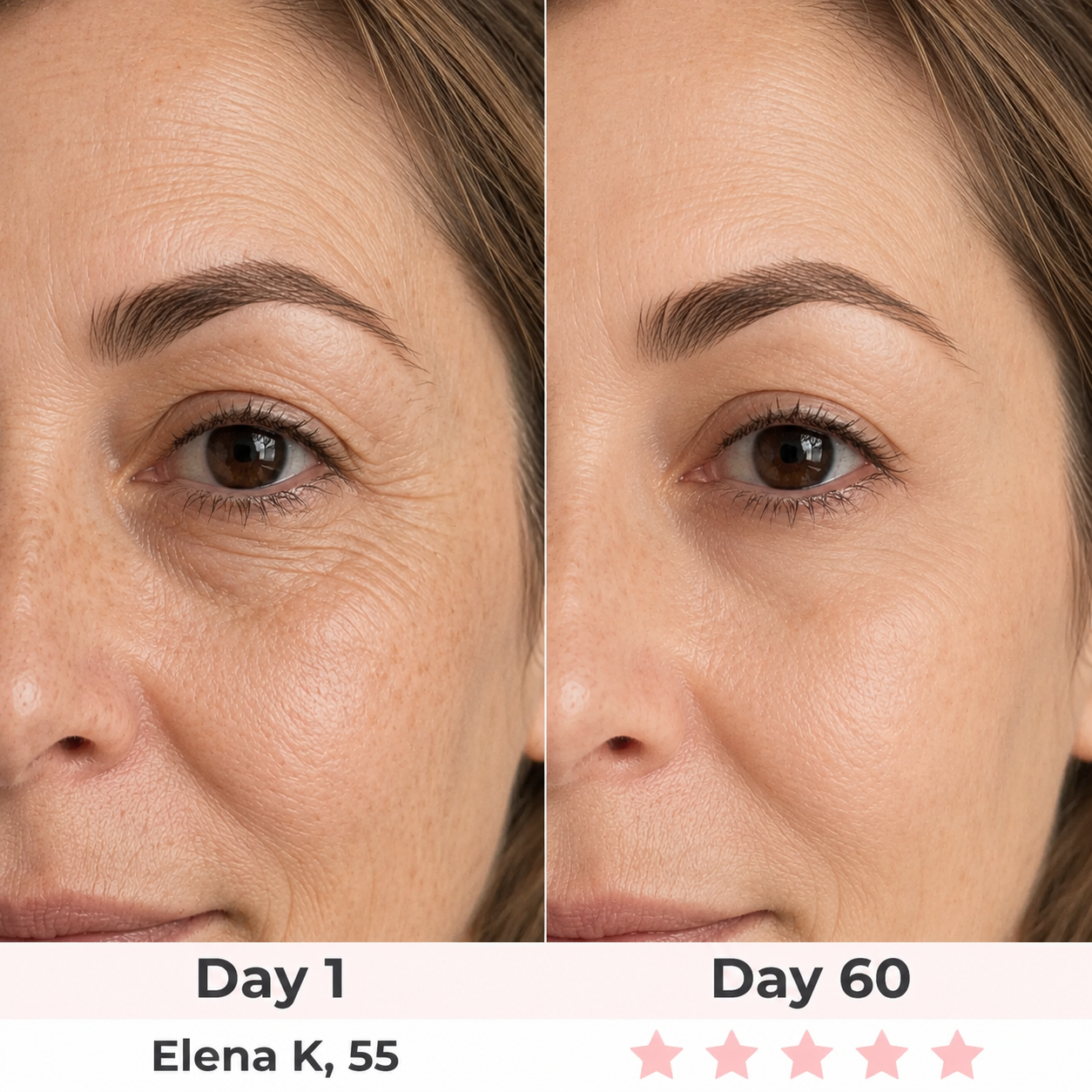LyraGlow™ 2-in-1 Red Light Therapy + EMS To Erase Eye Bags